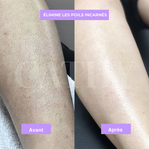 Sérum Anti-Repousse au Cyperus Rotundus