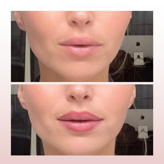 Peel-off Lip Liner Stain