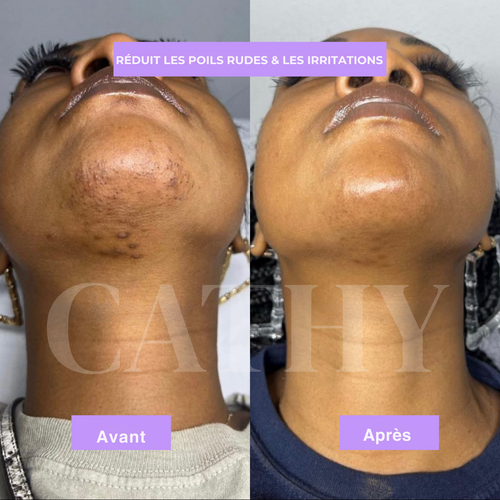 Sérum Anti-Repousse au Cyperus Rotundus