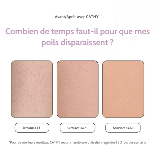 CATHY IPL Épilateur