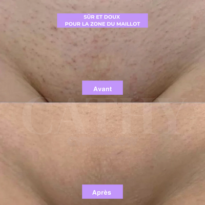 Sérum Anti-Repousse au Cyperus Rotundus