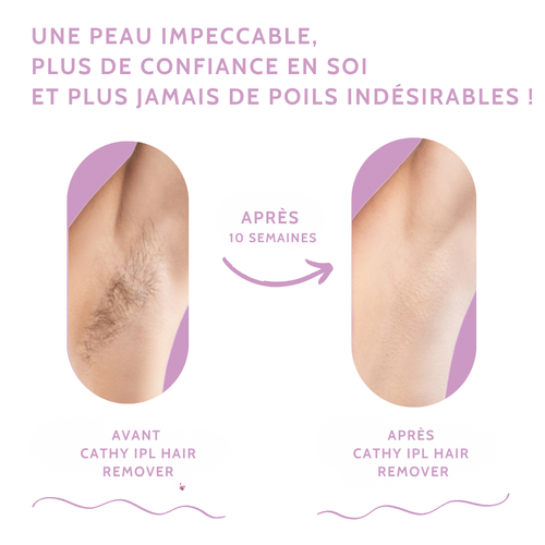CATHY IPL Épilateur